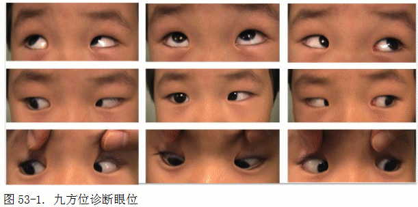 ZY016_281_5.gif